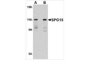 Western blot analysis of SPG15 in rat heart tissue lysate with SPG15 antibody at (A) 0. (ZFYVE26 Antikörper  (C-Term))