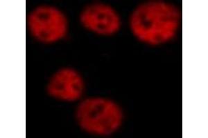 ABIN6267273 staining HeLa cells by ICC/IF. (Lamin A/C Antikörper  (pSer392))