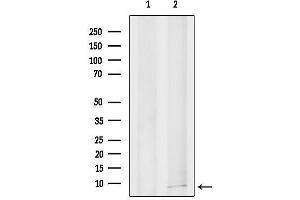 anti-Ribosomal Protein S29 (RPS29) (N-Term) antibody