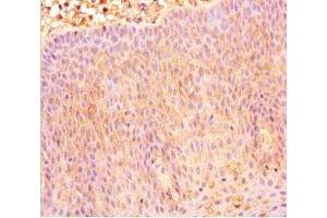 Immunohistochemistry of paraffin-embedded human tonsil tissue using ABIN7146107 at dilution of 1:100 (CXCR4 Antikörper  (AA 1-356))