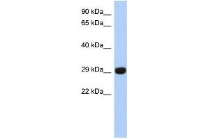 Western Blotting (WB) image for anti-Fructosamine 3 Kinase Related Protein (FN3KRP) antibody (ABIN2460081)