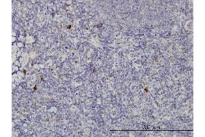 Immunoperoxidase of monoclonal antibody to NKIRAS2 on formalin-fixed paraffin-embedded human tonsil.