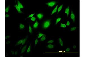 Immunofluorescence of monoclonal antibody to TESK2 on HeLa cell. (TESK2 Antikörper  (AA 405-542))