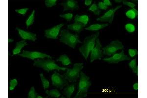 Immunofluorescence of monoclonal antibody to NDE1 on HeLa cell. (NDE1 Antikörper  (AA 1-335))