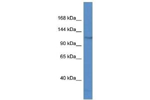 Western Blot showing FAM120C antibody used at a concentration of 1 ug/ml against Jurkat Cell Lysate (FAM120C Antikörper  (N-Term))