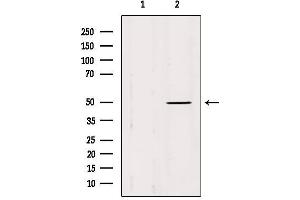 Western blot analysis of extracts from Mouse brain, using IFT52 Antibody. (IFT52 Antikörper  (Internal Region))