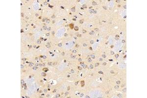 Immunohistochemistry analysis of paraffin-embedded mouse lung using,MFAP4 (ABIN7074614) at dilution of 1: 2000 (MFAP4 Antikörper)
