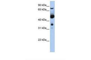 Image no. 1 for anti-Menage A Trois Homolog 1, Cyclin H Assembly Factor (Xenopus Laevis) (MNAT1) (N-Term) antibody (ABIN6739103) (MNAT1 Antikörper  (N-Term))