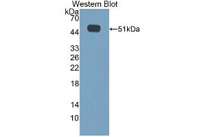 Detection of Recombinant CACNa1H, Mouse using Polyclonal Antibody to Calcium Channel, Voltage Dependent, T-Type, Alpha 1H Subunit (CACNa1H) (CACNA1H Antikörper  (AA 2160-2359))