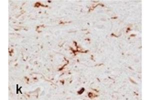 Immunohistochemistry (IHC) image for anti-Major Histocompatibility Complex, Class II, DR beta 1 (HLA-DRB1) antibody (ABIN2855994)