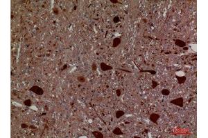 Immunohistochemistry (IHC) analysis of paraffin-embedded Rat Brain, antibody was diluted at 1:100. (Hexosaminidase A Antikörper  (Internal Region))