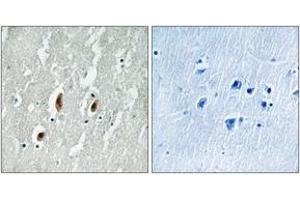Immunohistochemistry analysis of paraffin-embedded human brain tissue, using SRF (Ab-77) Antibody. (SRF Antikörper  (AA 41-90))