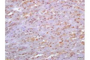 Formalin-fixed and paraffin embedded mouse stomach labeled with Anti-SDF4 Polyclonal Antibody, Unconjugated (ABIN720595) at 1:200 followed by conjugation to the secondary antibody and DAB staining (SDF4 Antikörper  (AA 121-230))
