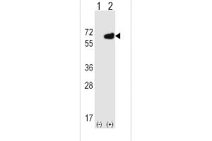 Western blot analysis of NT5E using rabbit polyclonal NT5E Antibody (M535) using 293 cell lysates (2 ug/lane) either nontransfected (Lane 1) or transiently transfected (Lane 2) with the NT5E gene. (CD73 Antikörper  (C-Term))