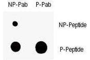 Dot blot analysis of nonphos (NP) and phospho-Wee1 antibody (P). (WEE1 Antikörper  (pSer123))