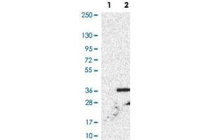 Western Blot analysis of Lane 1: negative control (vector only transfected HEK293T cell lysate) and Lane 2: over-expression lysate (co-expressed with a C-terminal myc-DDK tag in mammalian HEK293T cells) with XCR1 polyclonal antibody .