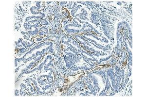IHC analysis of CD146/MCAM using anti-CD146/MCAM antibody (ABIN7602098).