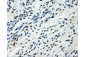 Immunohistochemical staining of paraffin-embedded endometrium tissue using anti-HK2mouse monoclonal antibody. (Hexokinase 2 Antikörper)