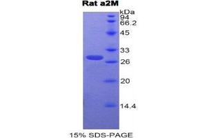 SDS-PAGE (SDS) image for alpha-2-Macroglobulin (A2M) (AA 818-1048) protein (His tag) (ABIN1878408)