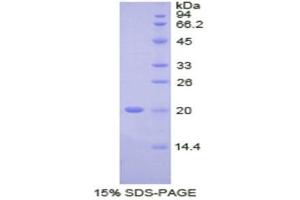SDS-PAGE (SDS) image for Fc Fragment of IgG Binding Protein (FCGBP) (AA 5176-5344) protein (His tag) (ABIN1525421)