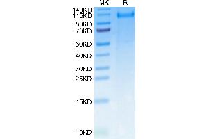 SDS-PAGE (SDS) image for CUB Domain Containing Protein 1 (CDCP1) (AA 29-666) protein (His tag) (ABIN7274298)