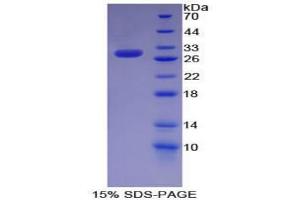 SDS-PAGE analysis of Mouse KHDRBS1 Protein.