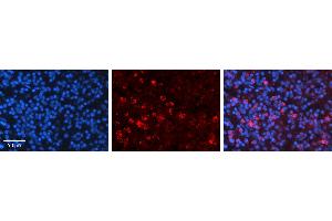 Rabbit Anti-CCNB1 Antibody   Formalin Fixed Paraffin Embedded Tissue: Human Lymph Node Tissue Observed Staining: Cytoplasm Primary Antibody Concentration: 1:600 Other Working Concentrations: N/A Secondary Antibody: Donkey anti-Rabbit-Cy3 Secondary Antibody Concentration: 1:200 Magnification: 20X Exposure Time: 0. (Cyclin B1 Antikörper  (C-Term))
