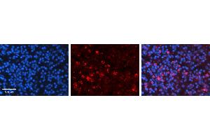 Rabbit Anti-CCNB1 Antibody   Formalin Fixed Paraffin Embedded Tissue: Human Lymph Node Tissue Observed Staining: Cytoplasm Primary Antibody Concentration: 1:600 Other Working Concentrations: N/A Secondary Antibody: Donkey anti-Rabbit-Cy3 Secondary Antibody Concentration: 1:200 Magnification: 20X Exposure Time: 0.