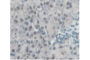 Immunohistochemistry (IHC) image for anti-Chemokine (C-C Motif) Ligand 2 (CCL2) (AA 24-96) antibody (ABIN7427900)