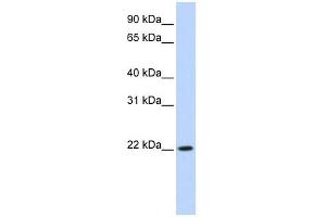RP11-529I10. (DPCD Antikörper  (Middle Region))