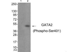Western blot analysis of extracts from JK cells (Lane 2), using GATA2 (Phospho-Ser401) Antibody. (GATA2 Antikörper  (pSer401))