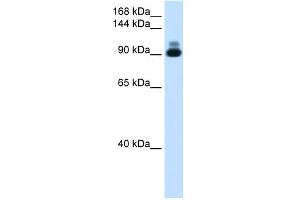 WB Suggested Anti-ACTN2 Antibody Titration:  1. (ACTN2 Antikörper  (C-Term))