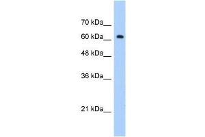 Human Jurkat; WB Suggested Anti-ZNF675 Antibody Titration: 1. (ZNF675 Antikörper  (C-Term))