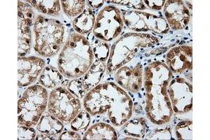 Immunohistochemical staining of paraffin-embedded Kidney tissue using anti-BTK mouse monoclonal antibody. (BTK Antikörper)