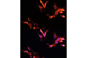Immunofluorescence analysis of NIH-3T3 cells using L Polyclonal Antibody (ABIN6133274, ABIN6143083, ABIN6143084 and ABIN6215309) at dilution of 1:100 (40x lens). (LAMTOR1 Antikörper  (AA 1-161))