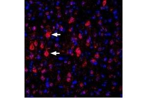 Immunohistochemistry (IHC) image for anti-Potassium Voltage-Gated Channel, Shaker-Related Subfamily, Member 4 (KCNA4) (AA 348-362), (Extracellular) antibody (ABIN7043526)