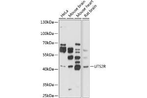 Western blot analysis of extracts of various cell lines, using UTS2R antibody (ABIN3017070, ABIN3017071, ABIN3017072 and ABIN6219939) at 1:1000 dilution. (UTS2R Antikörper  (AA 280-389))