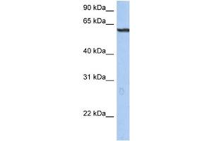 WB Suggested Anti-TRIM22 Antibody Titration: 0. (TRIM22 Antikörper  (N-Term))