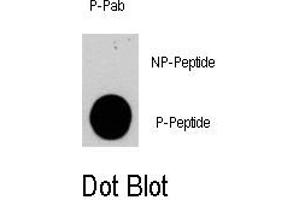 Image no. 1 for anti-Phosphoinositide-3-Kinase, Catalytic, gamma Polypeptide (PIK3CG) (pSer1100) antibody (ABIN358396)