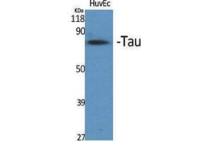 Western Blotting (WB) image for anti-tau Protein (Ser83) antibody (ABIN3177620) (tau Antikörper  (Ser83))