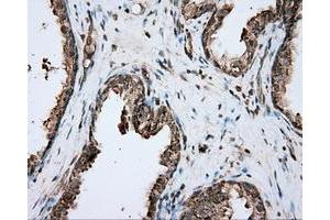 Immunohistochemical staining of paraffin-embedded prostate tissue using anti-PIM2 mouse monoclonal antibody. (PIM2 Antikörper)
