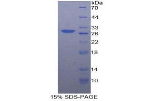 SDS-PAGE (SDS) image for Casein Kinase 1, alpha 1 (CSNK1A1) (AA 130-337) protein (His tag) (ABIN1879192) (CSNK1A1 Protein (AA 130-337) (His tag))