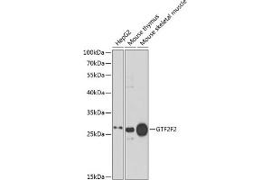 Western blot analysis of extracts of various cell lines, using GTF2F2 antibody (ABIN6131726, ABIN6141494, ABIN6141496 and ABIN6217519) at 1:1000 dilution. (GTF2F2 Antikörper  (AA 1-249))