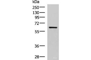 Western blot analysis of Human fetal brain tissue lysate using SARS Polyclonal Antibody at dilution of 1:850 (Seryl-tRNA Synthetase (SARS) Antikörper)