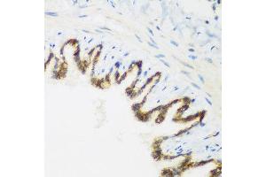 Immunohistochemistry of paraffin-embedded rat lung using KIAA1456 antibody at dilution of 1:200 (40x lens).