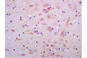 Formalin-fixed and paraffin embedded rat brain labeled with Anti-Sulfatase 2 Polyclonal Antibody, Unconjugated (ABIN750763) at 1:200 followed by conjugation to the secondary antibody and DAB staining