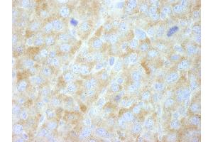 Immunohistochemistry (IHC) image for anti-Fatty Acid Synthase (FASN) (AA 2462-2511) antibody (ABIN7448964)