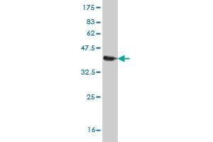 Western Blot detection against Immunogen (37. (S100A11 Antikörper  (AA 1-105))