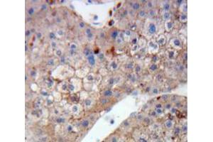 Used in DAB staining on fromalin fixed paraffin-embedded Liver tissue (DCT Antikörper  (AA 28-263))