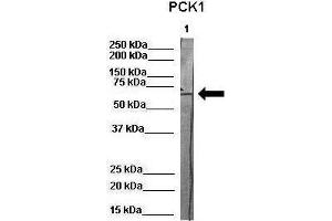 WB Suggested Anti-PCK1 Antibody    Positive Control:  Lane 1: 80ug pig serum protein   Primary Antibody Dilution :   1:1000  Secondary Antibody :  Anti-rabbit-HRP   Secondry Antibody Dilution :   1:500  Submitted by:  Martina Ondrovics, University of Veterinary Medicine Vienna
